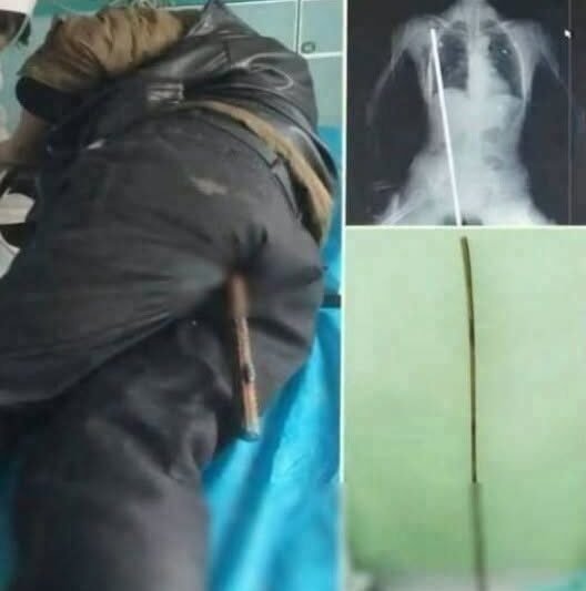Cuando la hoja atravesó el abdom